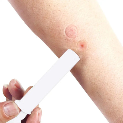 Safety Venom Extractor Pump Kit Poison Remover Set Survival Gear First Aid Supply Venom Vacuum Aspirator For Outdoor Camping